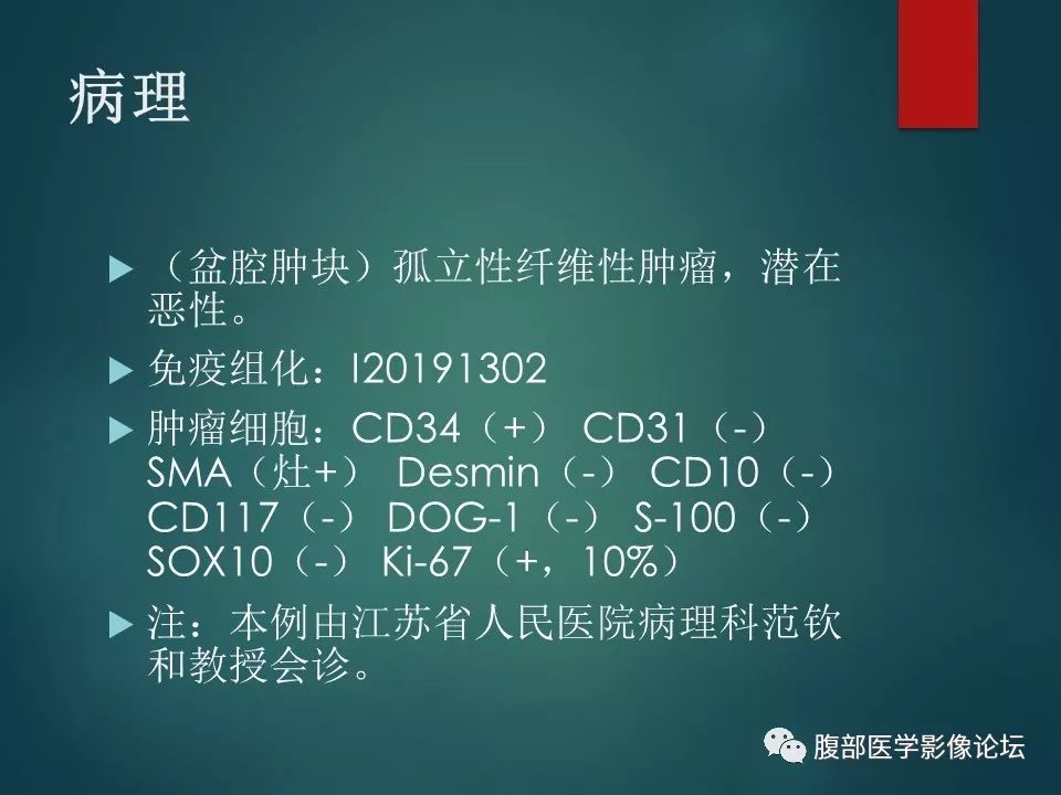 【病例】盆腔孤立性纤维性肿瘤1例MR