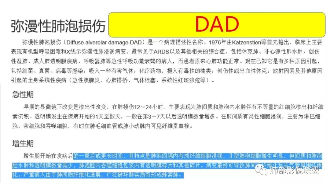 【PPT】病毒性肺炎影像诊断
