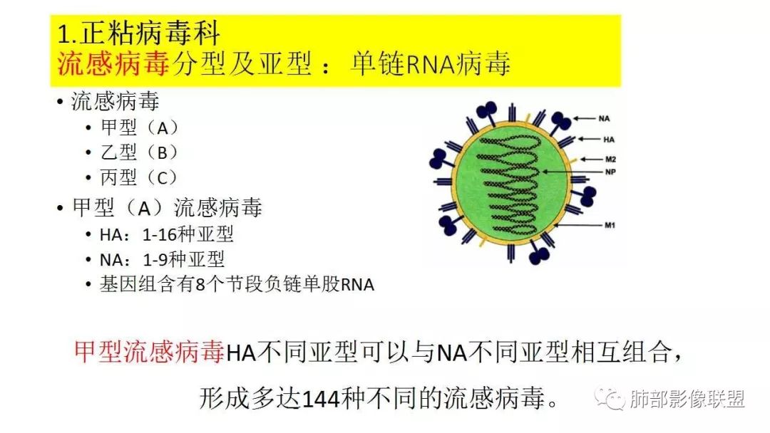 【PPT】病毒性肺炎影像诊断