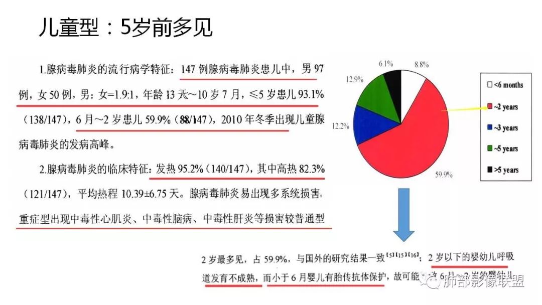 【PPT】病毒性肺炎影像诊断