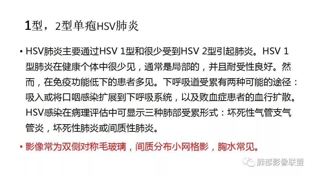 【PPT】病毒性肺炎影像诊断