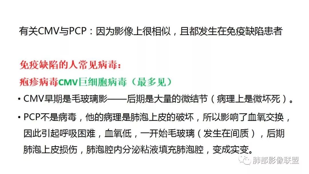 【PPT】病毒性肺炎影像诊断