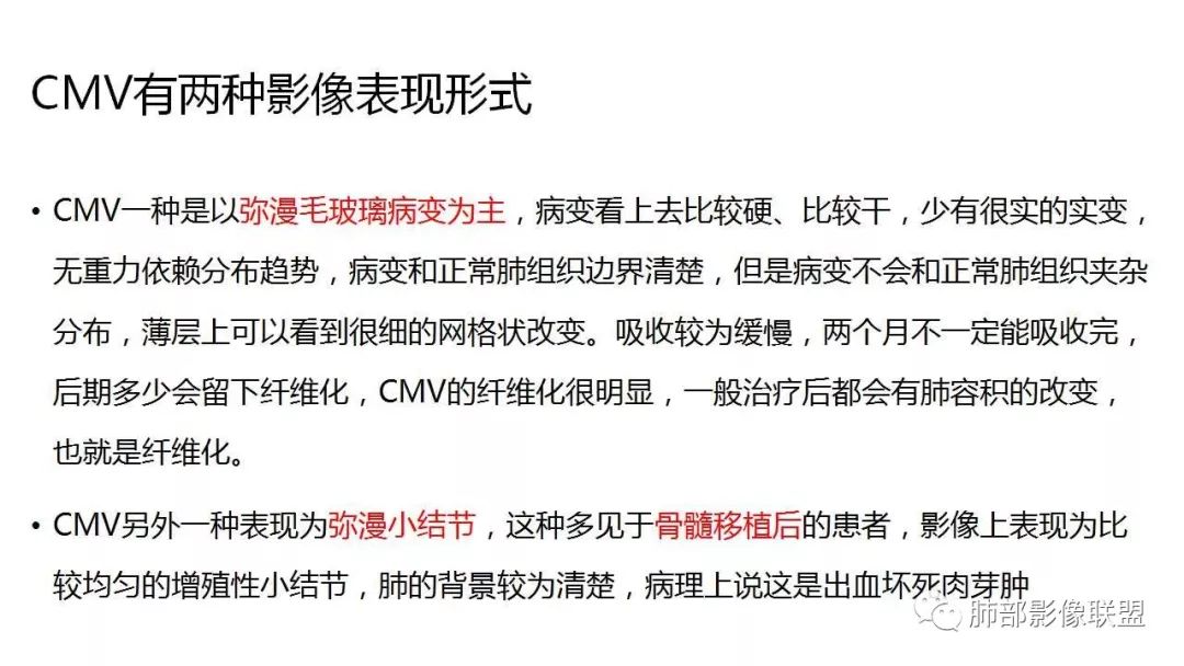 【PPT】病毒性肺炎影像诊断