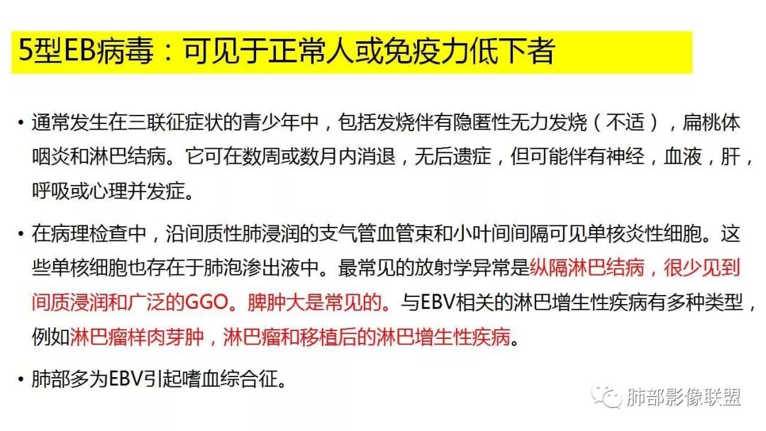 【PPT】病毒性肺炎影像诊断