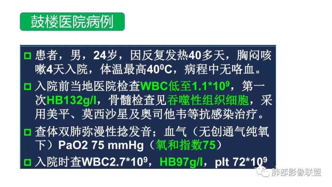 【PPT】病毒性肺炎影像诊断