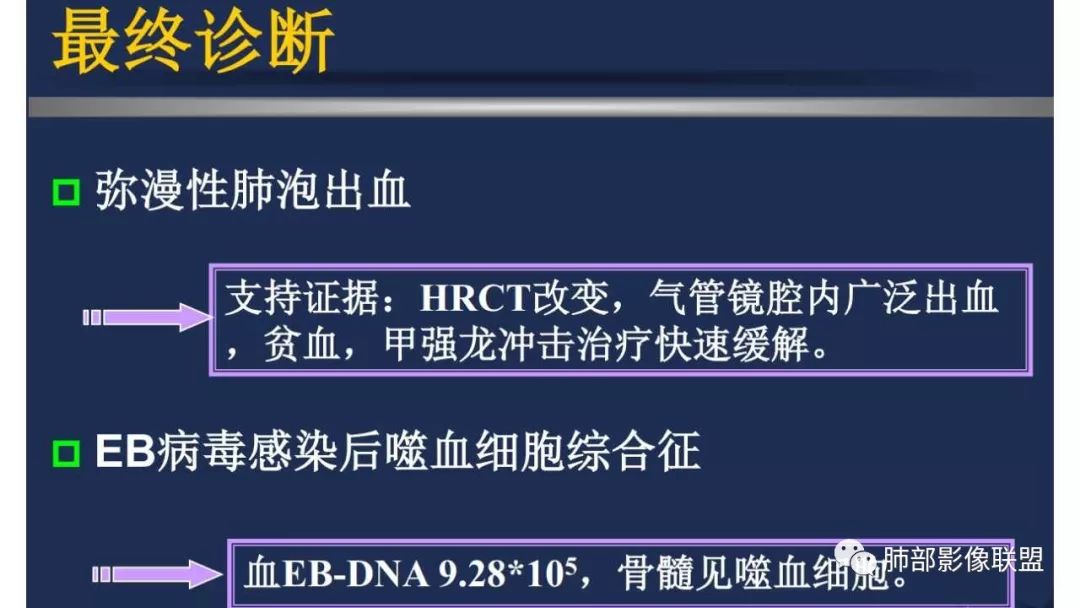 【PPT】病毒性肺炎影像诊断