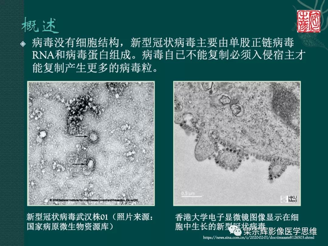 【PPT】新型冠状病毒（COVID-19）肺炎概念与CT表现