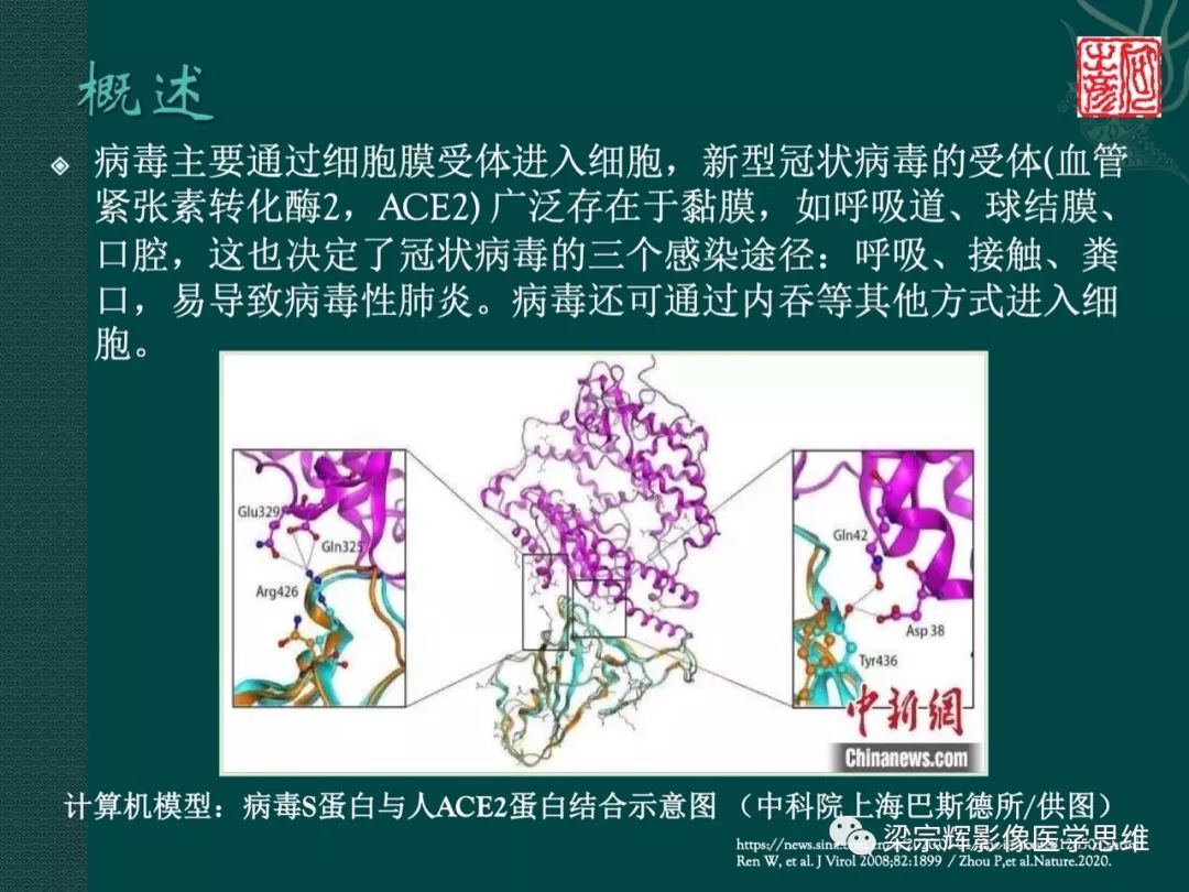 【PPT】新型冠状病毒（COVID-19）肺炎概念与CT表现