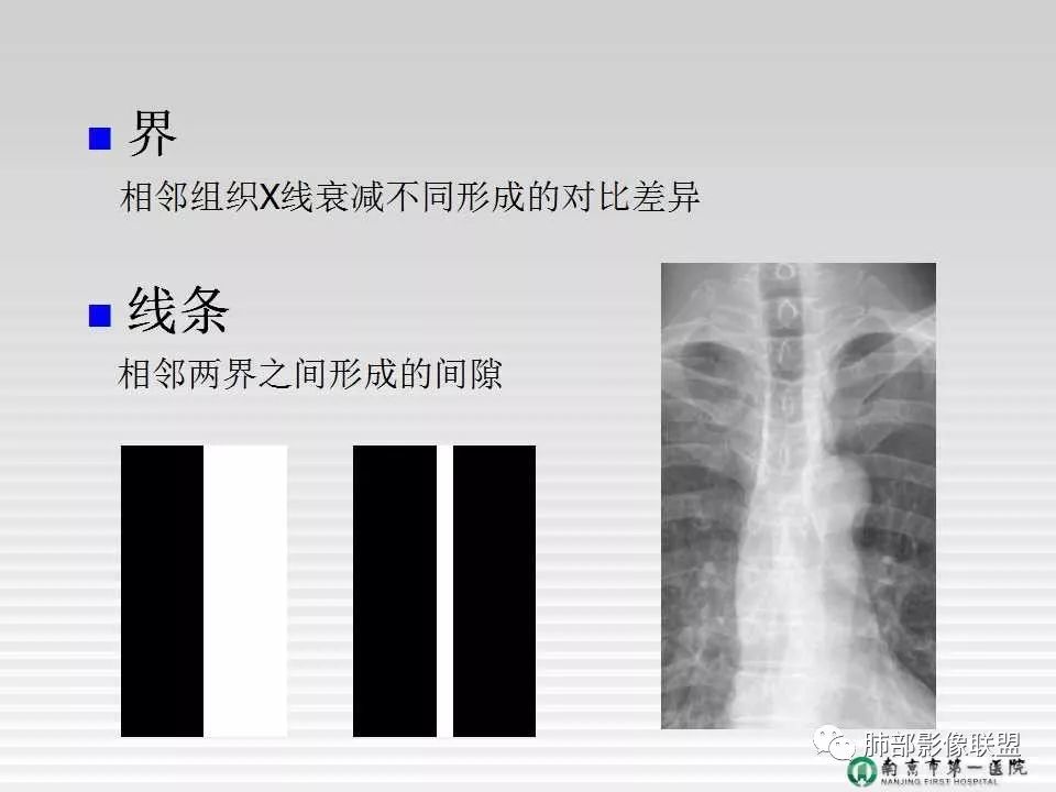 【PPT】胸片中的界与线——识别隐匿者与伪装者