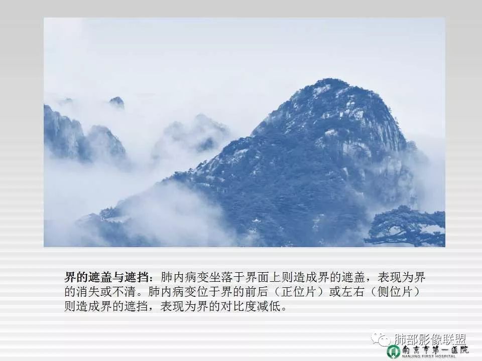 【PPT】胸片中的界与线——识别隐匿者与伪装者
