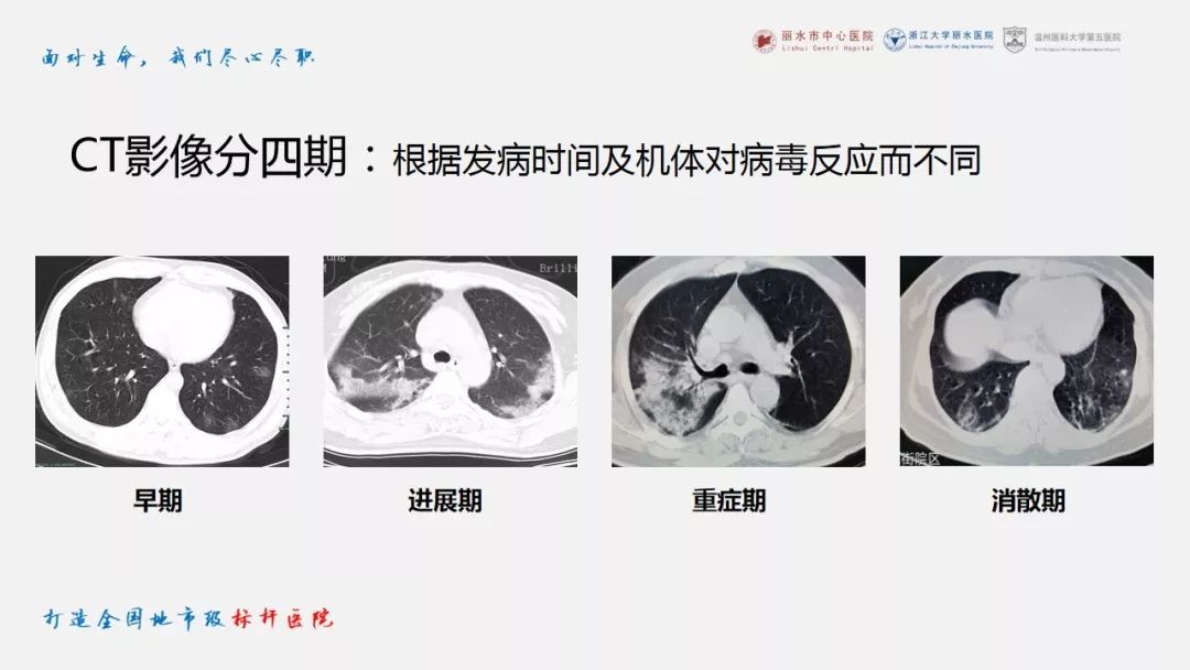 【PPT】新冠肺炎CT早期征象与临床基础及鉴别诊断