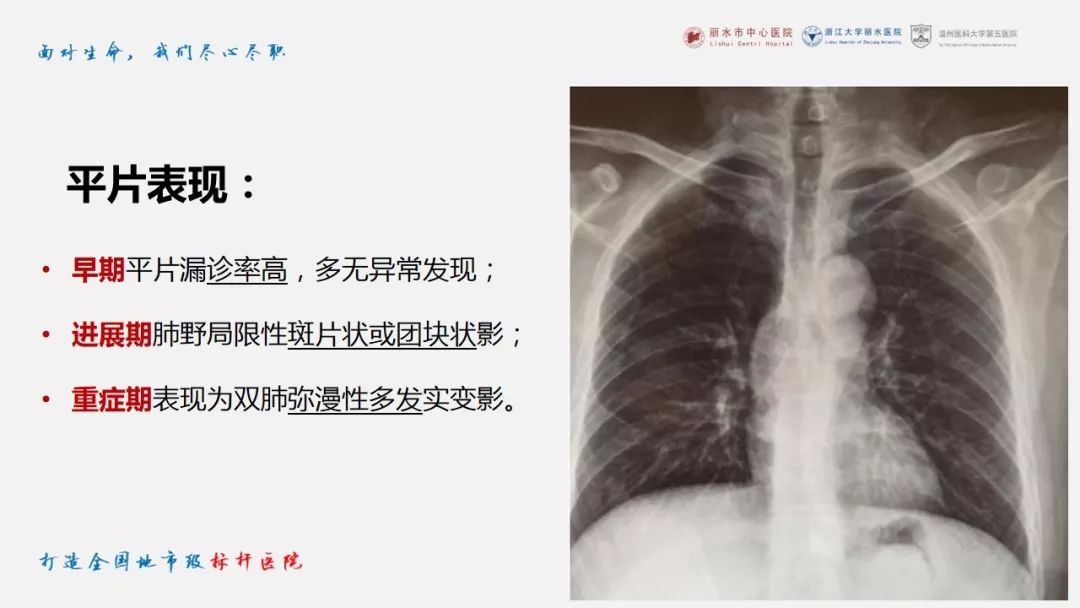 【PPT】新冠肺炎CT早期征象与临床基础及鉴别诊断