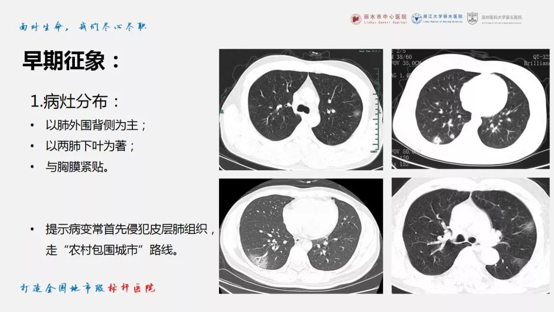 【PPT】新冠肺炎CT早期征象与临床基础及鉴别诊断