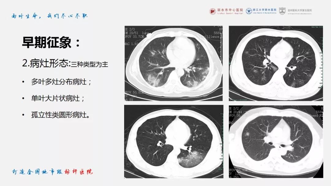 【PPT】新冠肺炎CT早期征象与临床基础及鉴别诊断