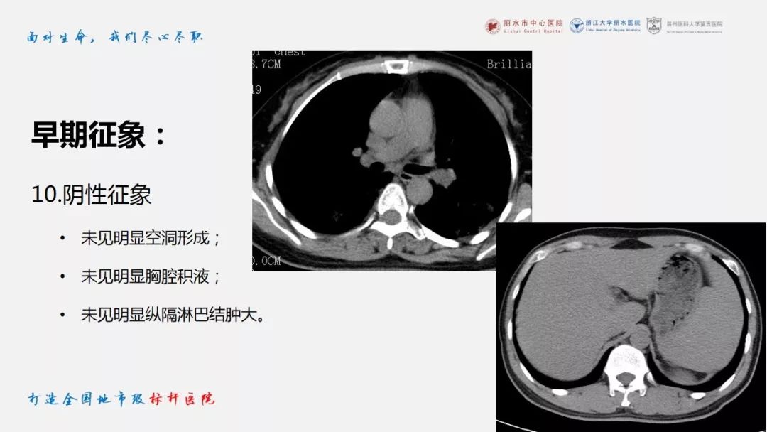 【PPT】新冠肺炎CT早期征象与临床基础及鉴别诊断