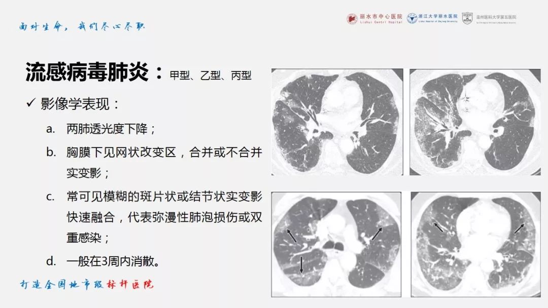 【PPT】新冠肺炎CT早期征象与临床基础及鉴别诊断