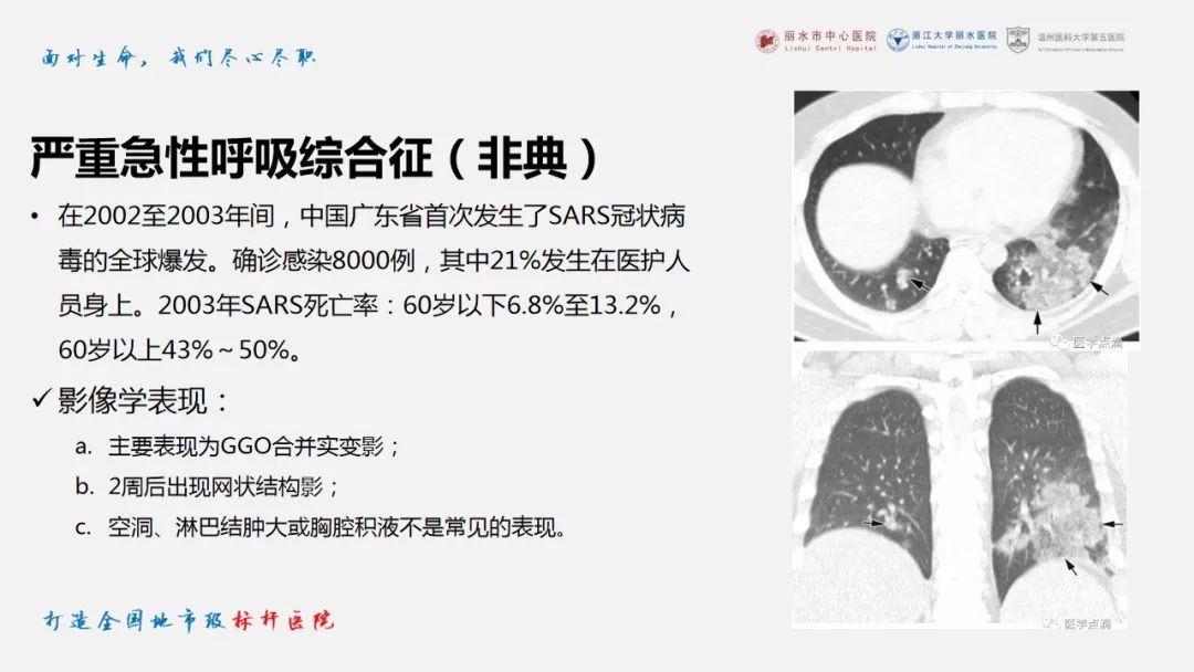 【PPT】新冠肺炎CT早期征象与临床基础及鉴别诊断
