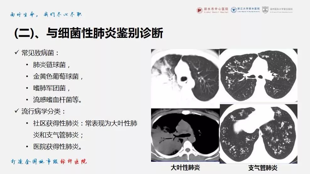 【PPT】新冠肺炎CT早期征象与临床基础及鉴别诊断