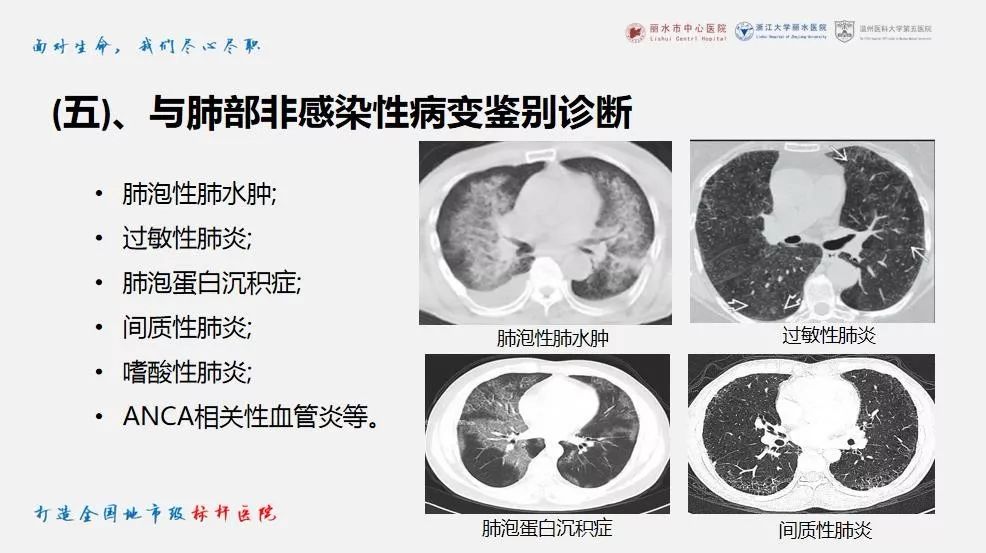 【PPT】新冠肺炎CT早期征象与临床基础及鉴别诊断