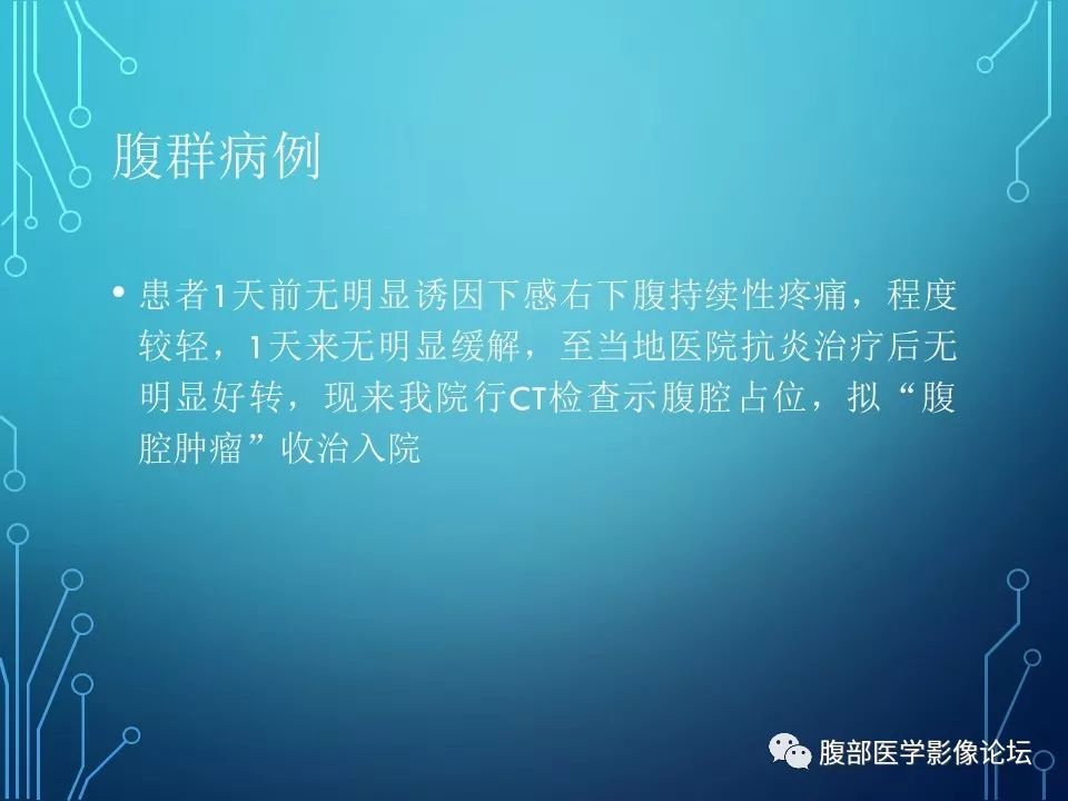 【病例】小肠间质瘤1例CT影像
