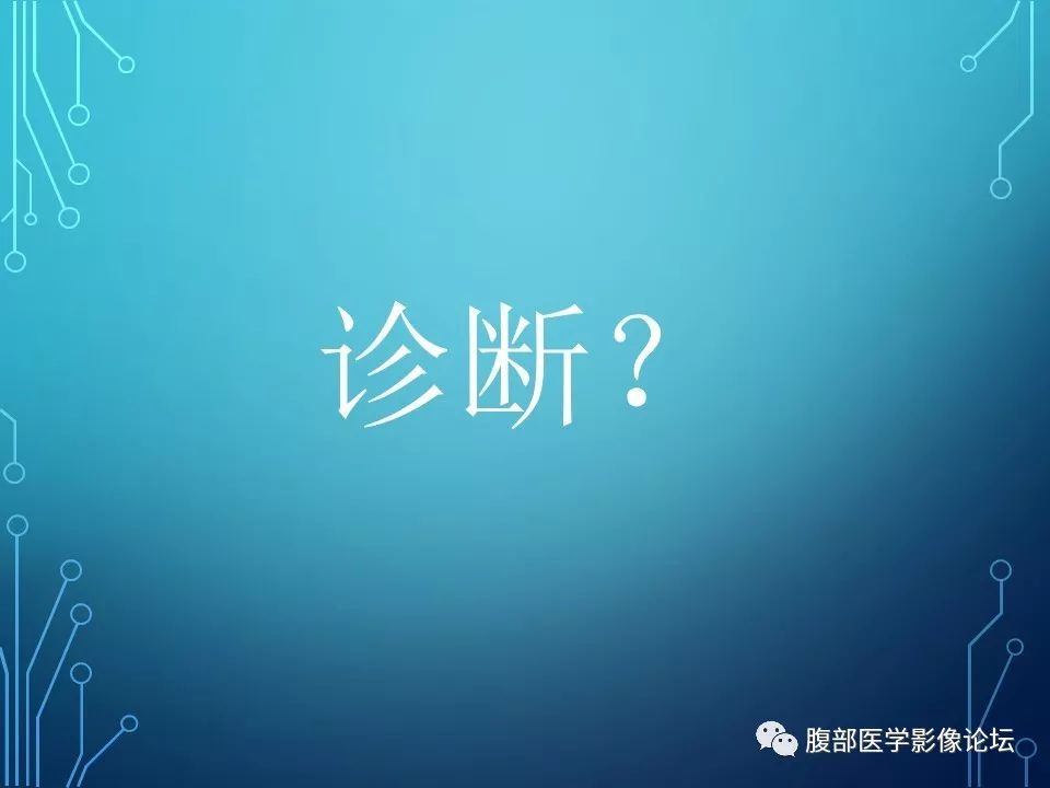 【病例】小肠间质瘤1例CT影像