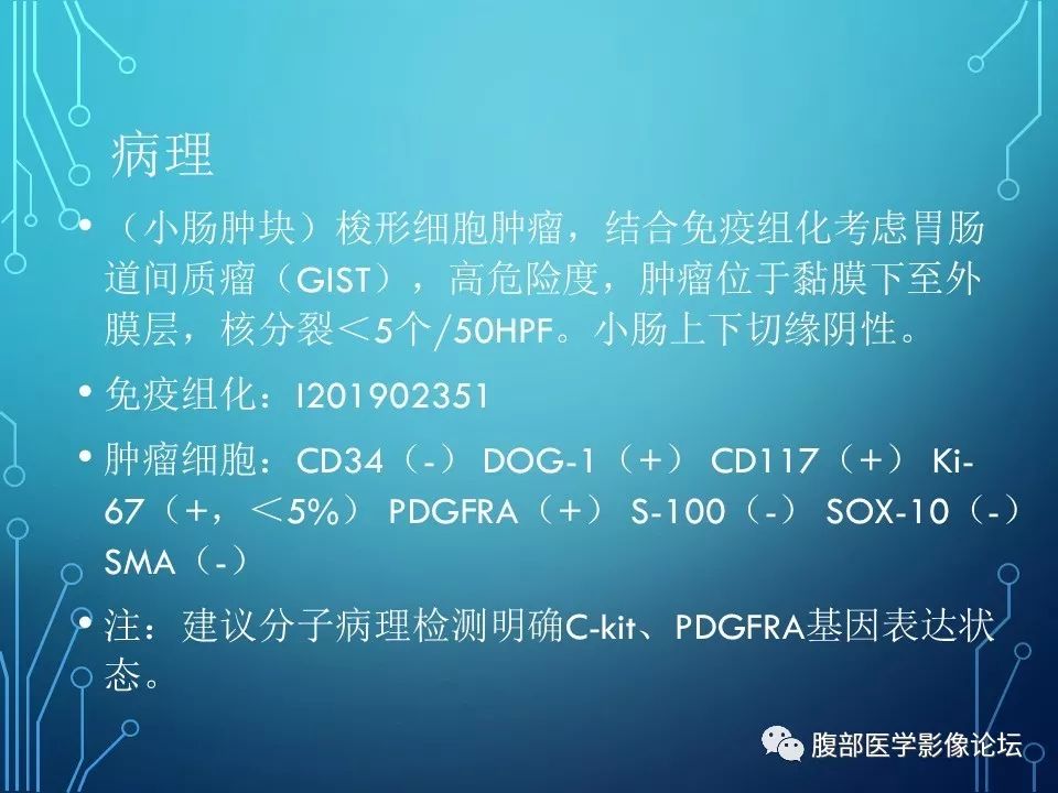 【病例】小肠间质瘤1例CT影像