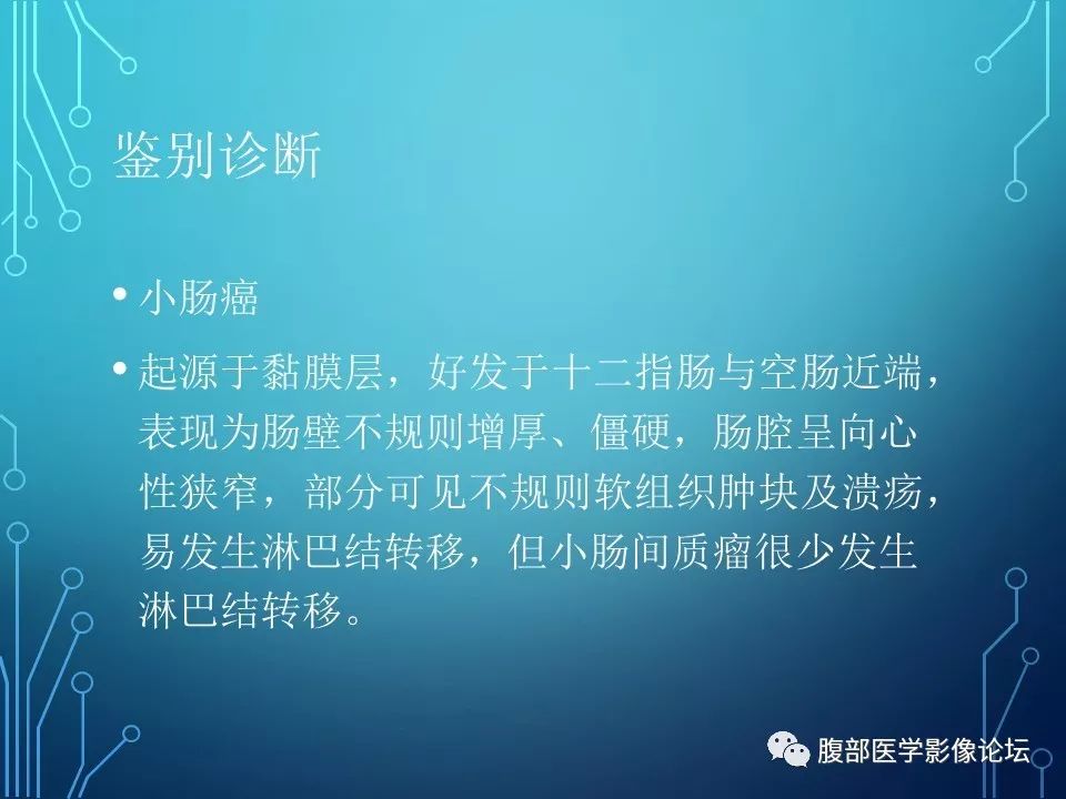 【病例】小肠间质瘤1例CT影像