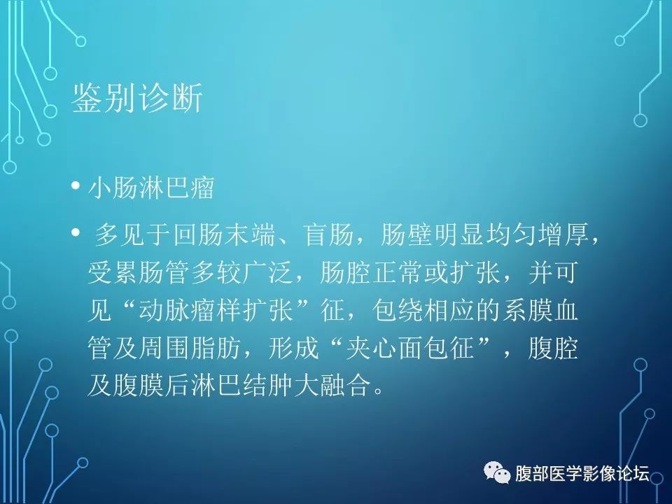 【病例】小肠间质瘤1例CT影像