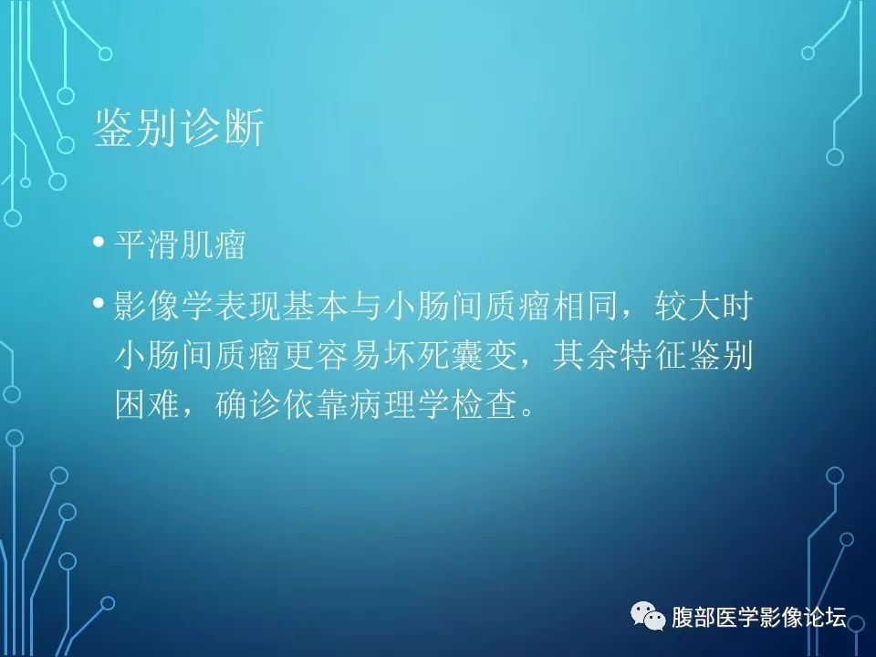 【病例】小肠间质瘤1例CT影像