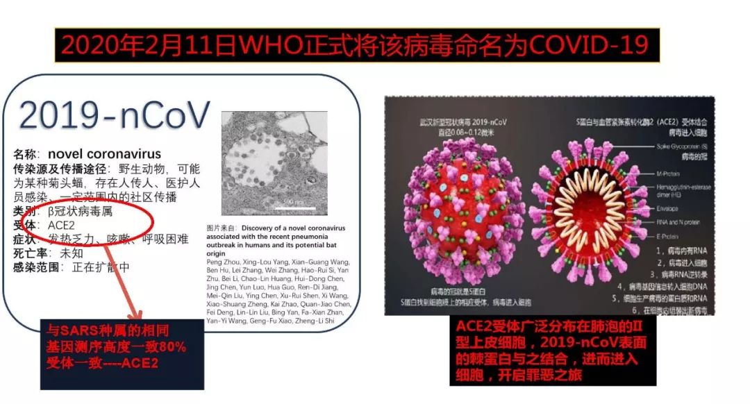 【PPT】以史为鉴，以影为鉴--COVID-19CT诊断、鉴别诊断与思考