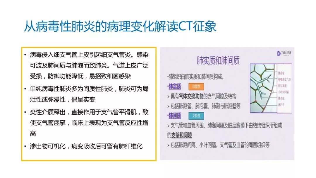 【PPT】以史为鉴，以影为鉴--COVID-19CT诊断、鉴别诊断与思考