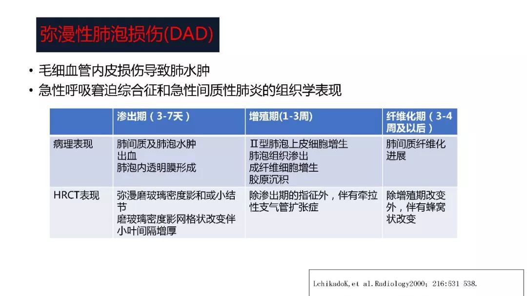 【PPT】以史为鉴，以影为鉴--COVID-19CT诊断、鉴别诊断与思考