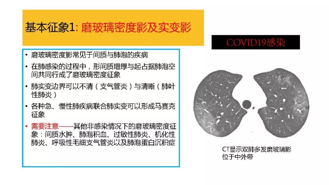 【PPT】以史为鉴，以影为鉴--COVID-19CT诊断、鉴别诊断与思考