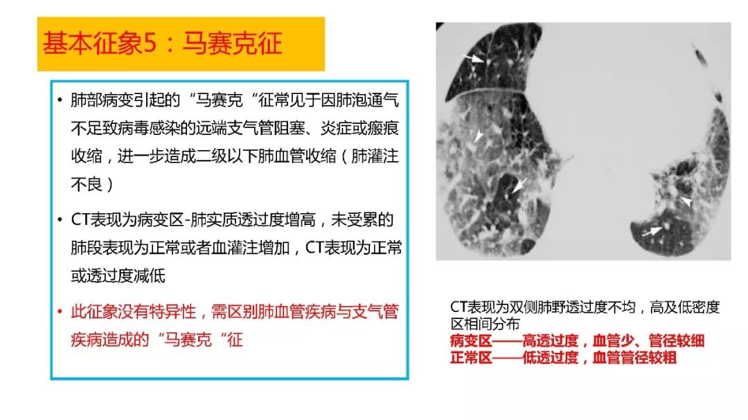 【PPT】以史为鉴，以影为鉴--COVID-19CT诊断、鉴别诊断与思考