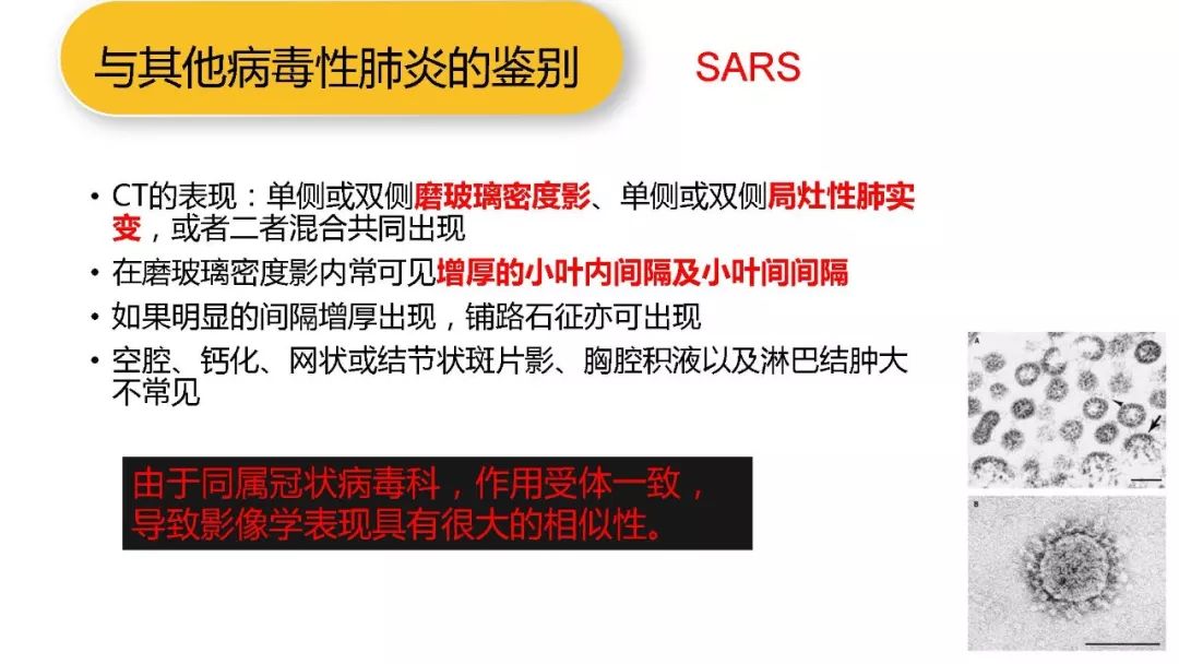 【PPT】以史为鉴，以影为鉴--COVID-19CT诊断、鉴别诊断与思考