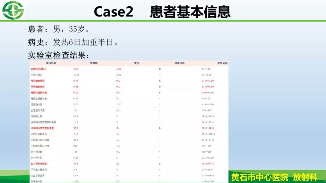 【PPT】新型冠状病毒（2019-nCoV）肺炎影像学表现病例分享