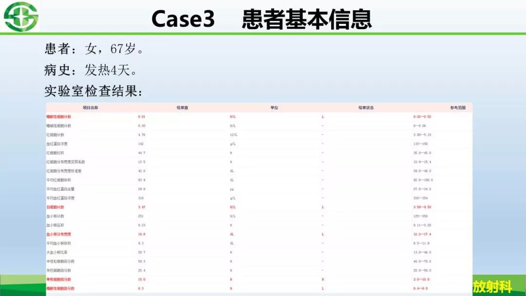 【PPT】新型冠状病毒（2019-nCoV）肺炎影像学表现病例分享