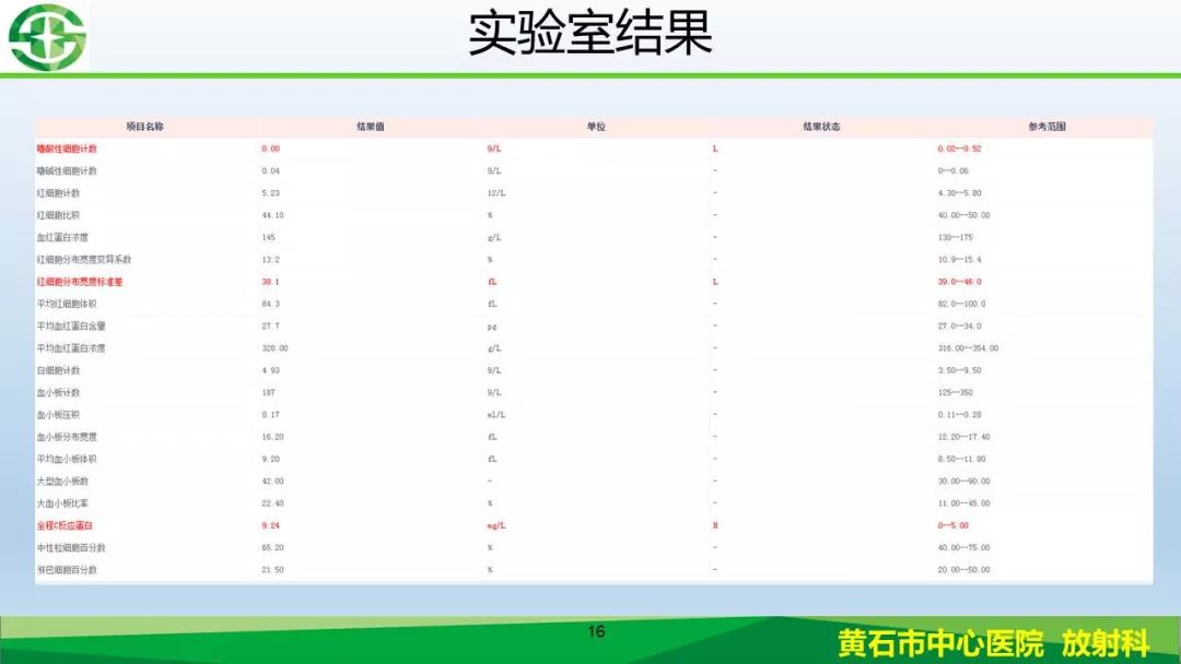 【PPT】新型冠状病毒（2019-nCoV）肺炎影像学表现病例分享