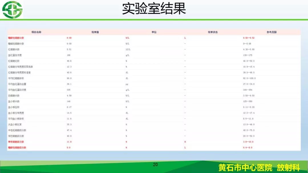 【PPT】新型冠状病毒（2019-nCoV）肺炎影像学表现病例分享
