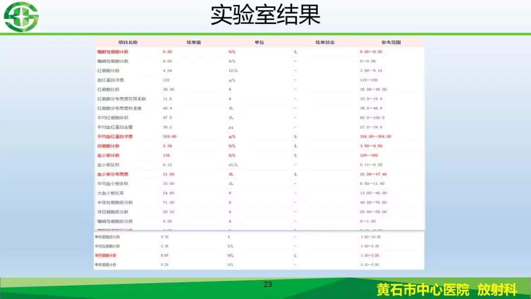 【PPT】新型冠状病毒（2019-nCoV）肺炎影像学表现病例分享