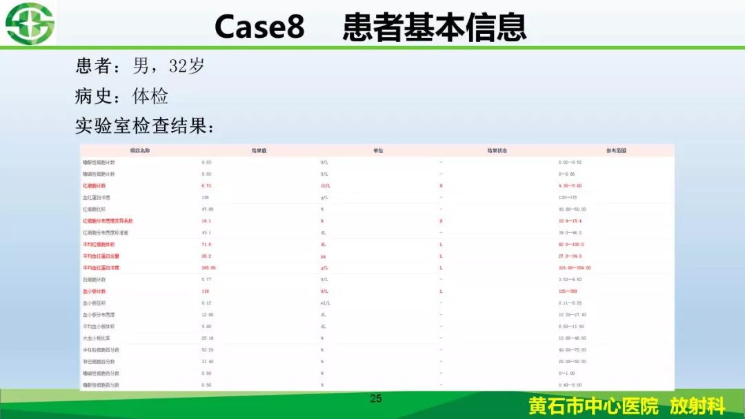 【PPT】新型冠状病毒（2019-nCoV）肺炎影像学表现病例分享