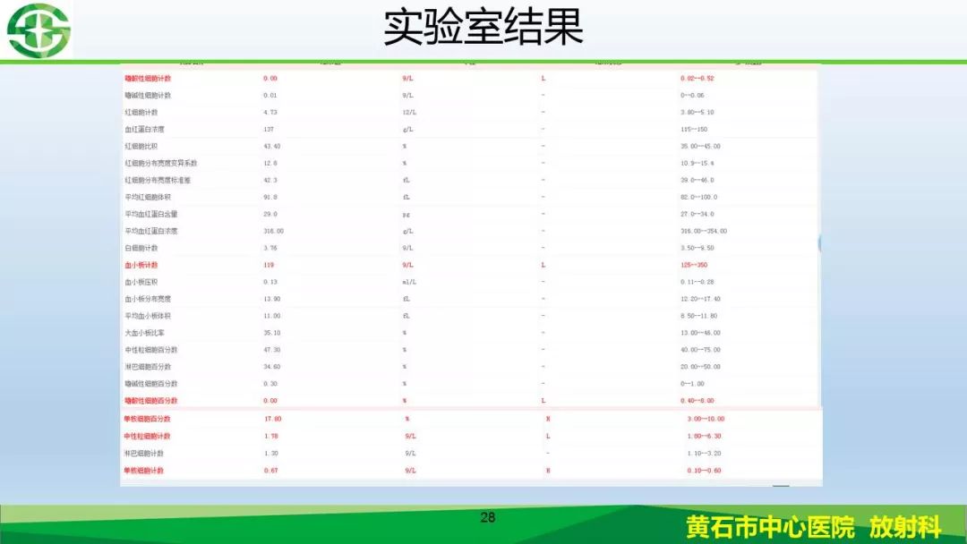 【PPT】新型冠状病毒（2019-nCoV）肺炎影像学表现病例分享
