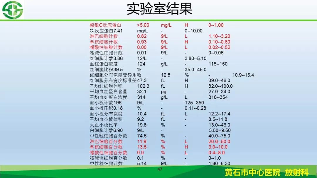 【PPT】新型冠状病毒（2019-nCoV）肺炎影像学表现病例分享