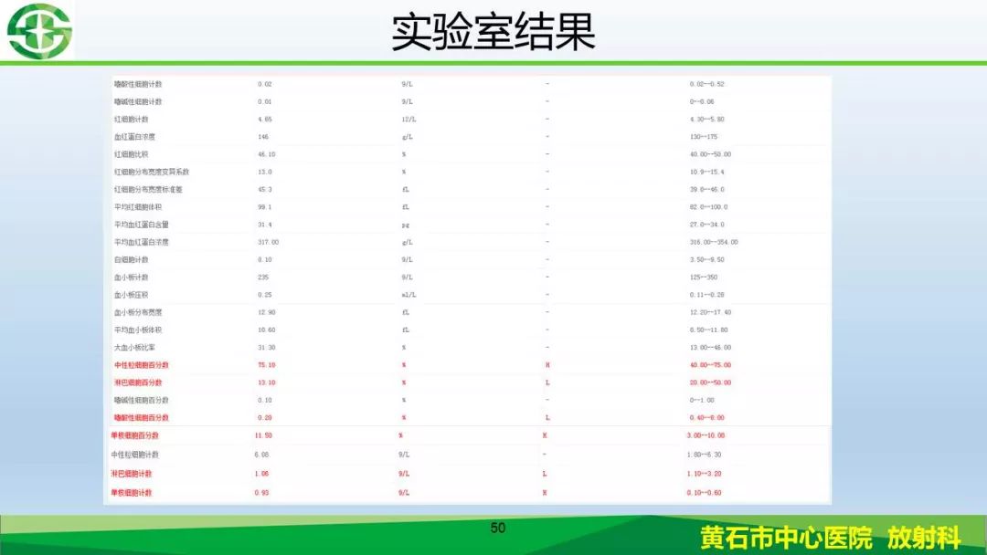 【PPT】新型冠状病毒（2019-nCoV）肺炎影像学表现病例分享