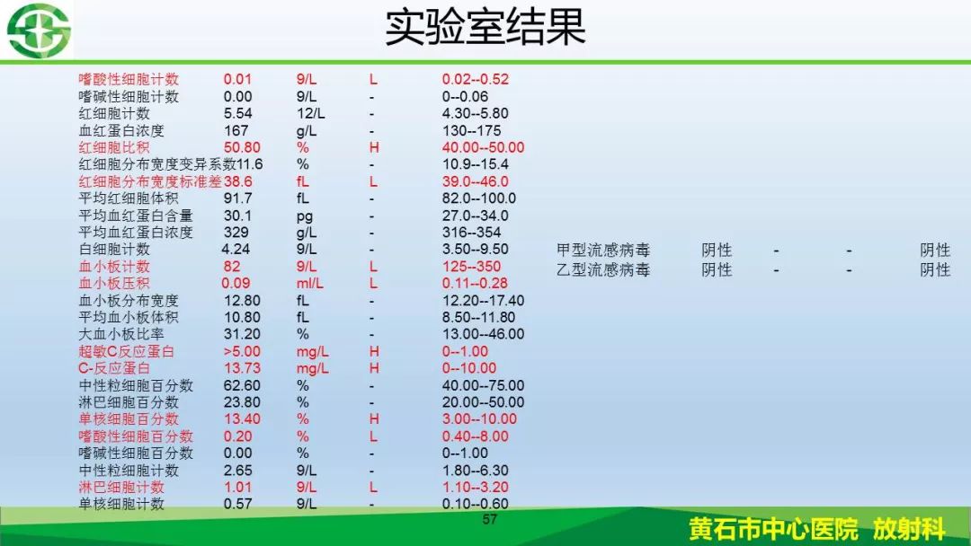 【PPT】新型冠状病毒（2019-nCoV）肺炎影像学表现病例分享