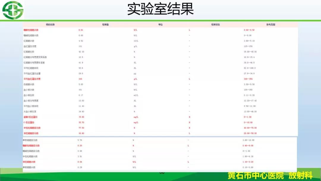【PPT】新型冠状病毒（2019-nCoV）肺炎影像学表现病例分享
