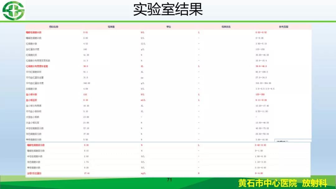 【PPT】新型冠状病毒（2019-nCoV）肺炎影像学表现病例分享