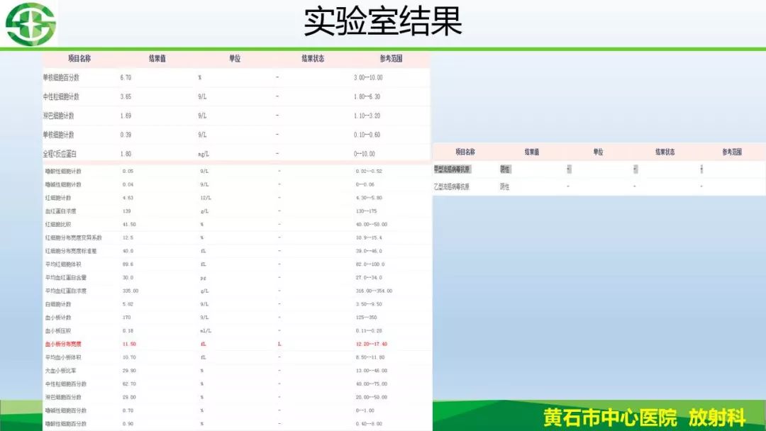 【PPT】新型冠状病毒（2019-nCoV）肺炎影像学表现病例分享
