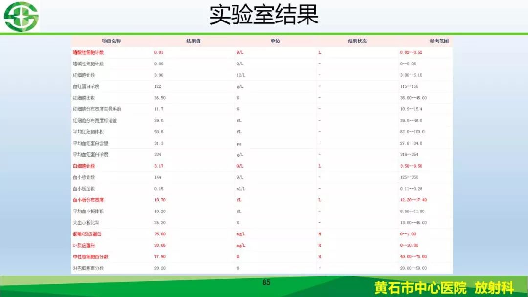 【PPT】新型冠状病毒（2019-nCoV）肺炎影像学表现病例分享