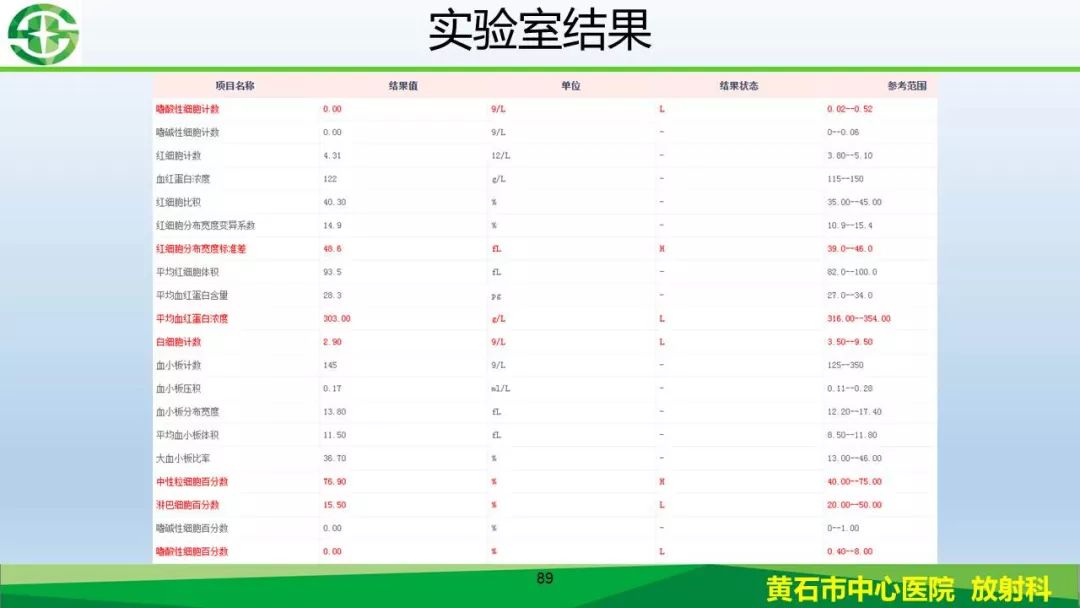 【PPT】新型冠状病毒（2019-nCoV）肺炎影像学表现病例分享